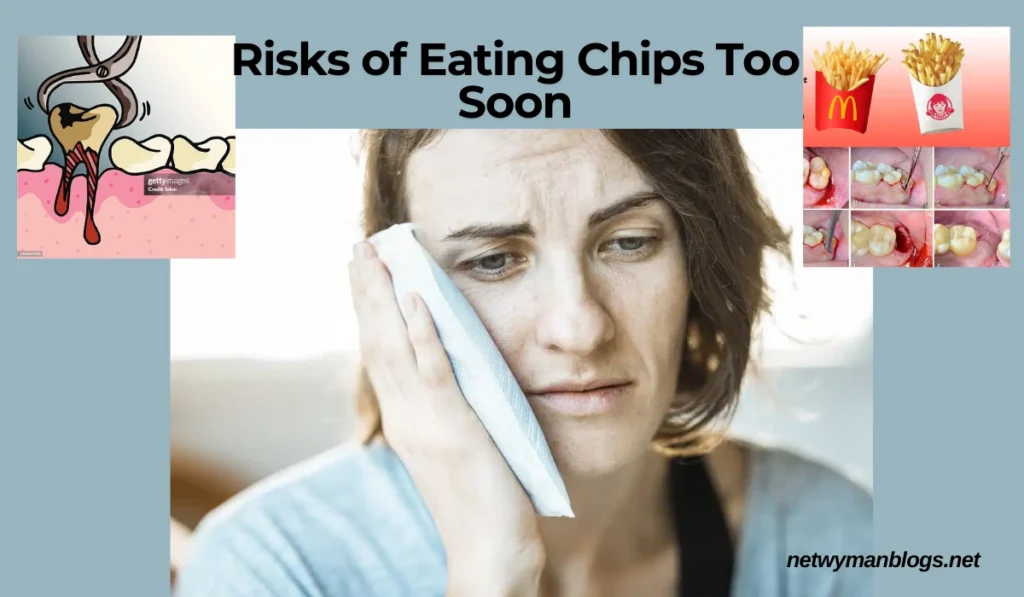 When Can I Eat Chips After Wisdom Teeth Removal