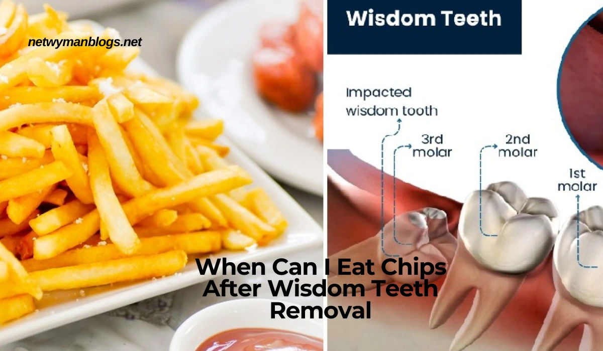 When Can I Eat Chips After Wisdom Teeth Removal